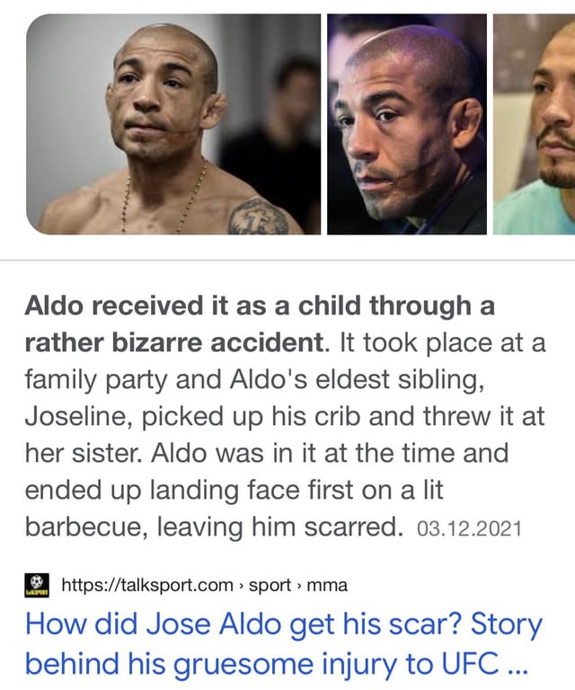 Jose Aldo Scar: What Happened and How It Looks Now