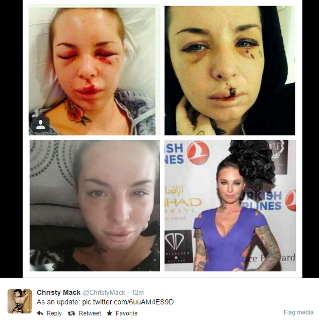 Christy Mack Before and After: See Her Transformation!